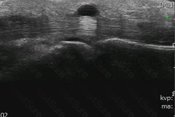 RhMSUS Question 21
